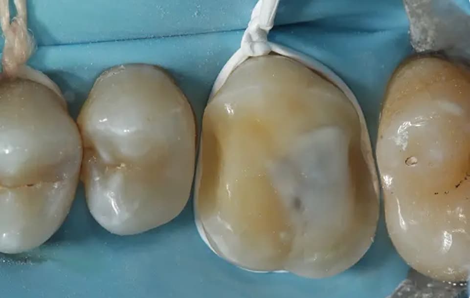 Clear Preparation Protocols
